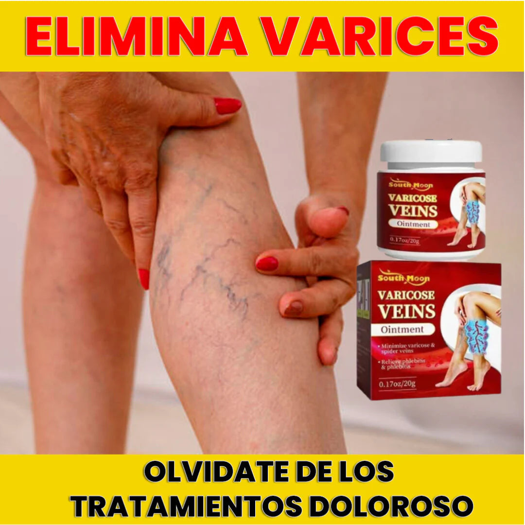 🦵VARICOSE VEINS - CREMA ELIMINA VARICES 💫
