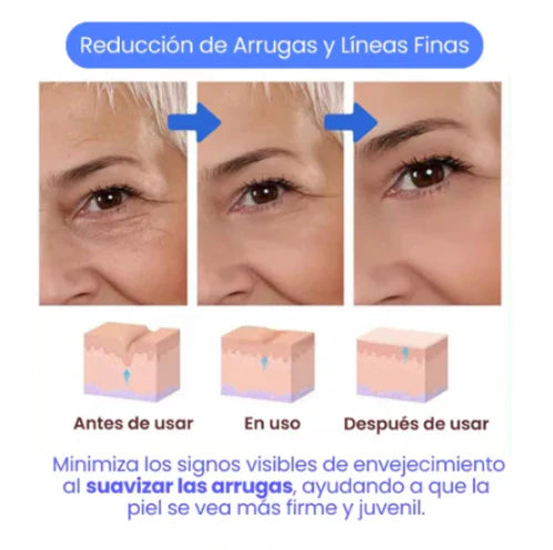 🧴BOTOX STOCK SOLUTION – SÉRUM ANTIEDAD REAFIRMANTE PARA UNA PIEL RADIANTE PROMOCIÓN 2 X 1 🎉