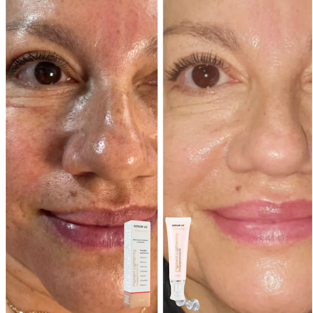 CREMA TEXTURA EN GEL PARA ELIMINAR MANCHAS Y CICATRICES✅