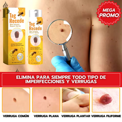 💧🔥 TAG RECEDE ELIMINADOR DE VERRUGAS 🔥💧