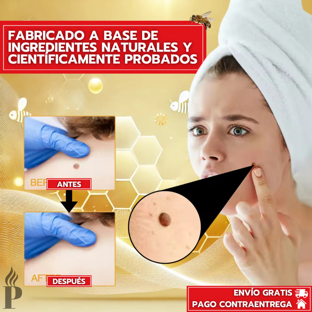 💧🔥 TAG RECEDE ELIMINADOR DE VERRUGAS 🔥💧