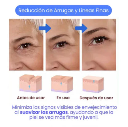 🧴BOTOX STOCK SOLUTION – SÉRUM ANTIEDAD REAFIRMANTE PARA UNA PIEL RADIANTE  PROMOCIÓN 2 X 1 🎉