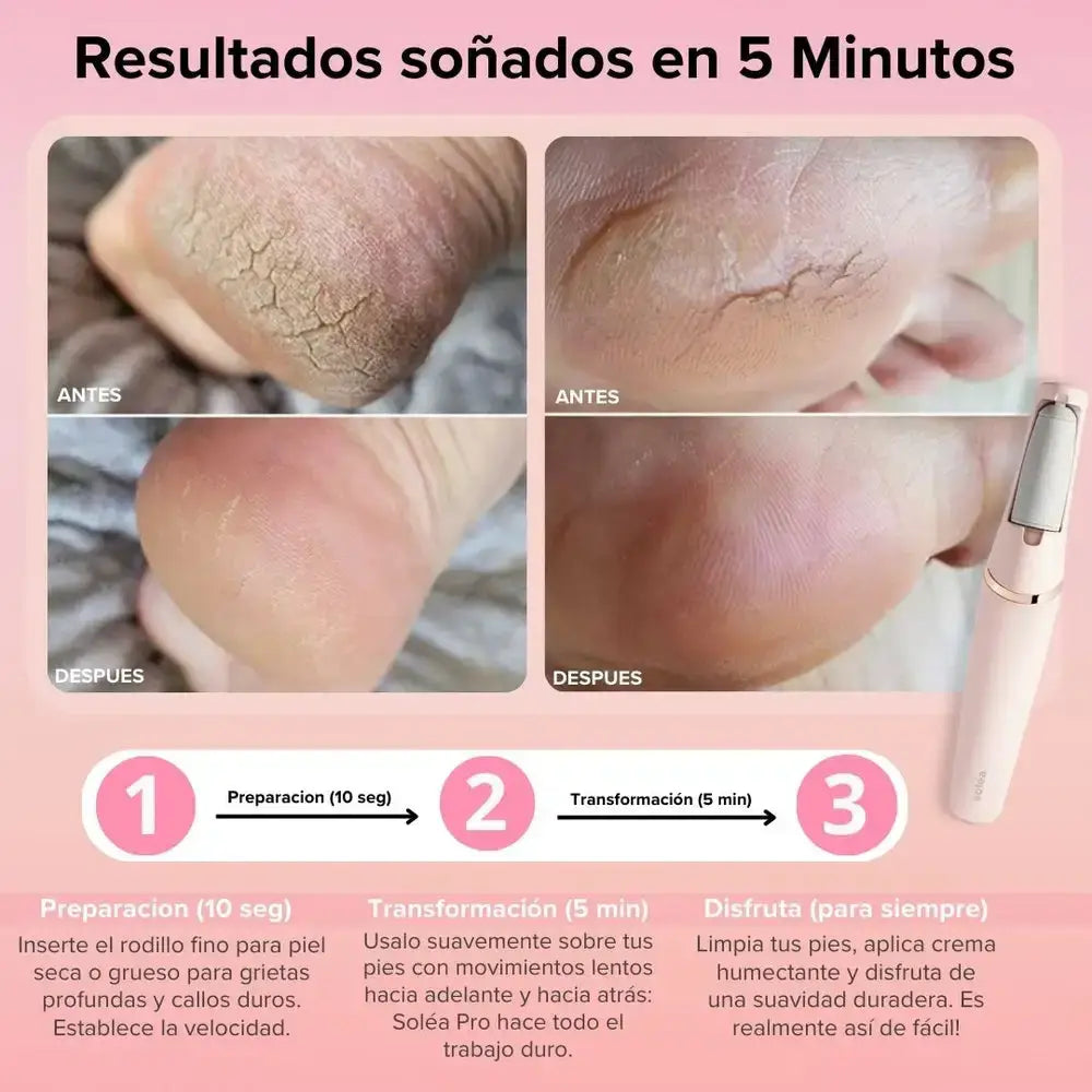 🦶✨ MÁQUINA REMOVEDOR DE CALLOS ✨🦶