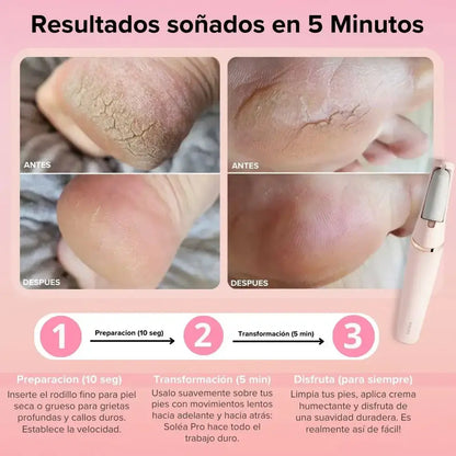 🦶✨ MÁQUINA REMOVEDOR DE CALLOS ✨🦶