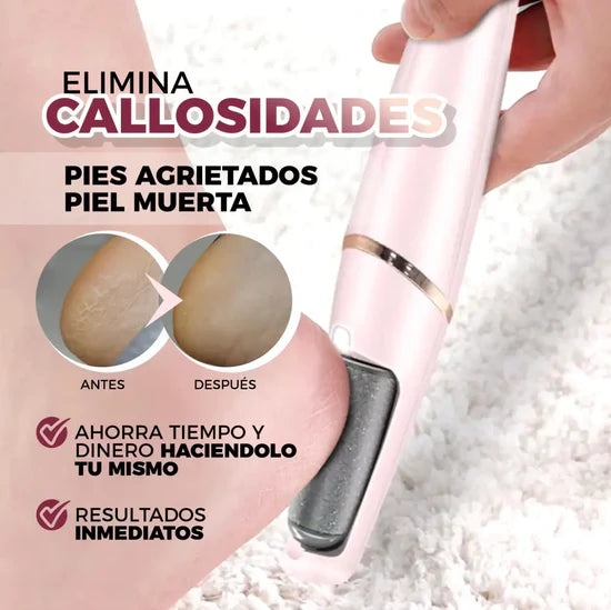 🦶✨ MÁQUINA REMOVEDOR DE CALLOS ✨🦶